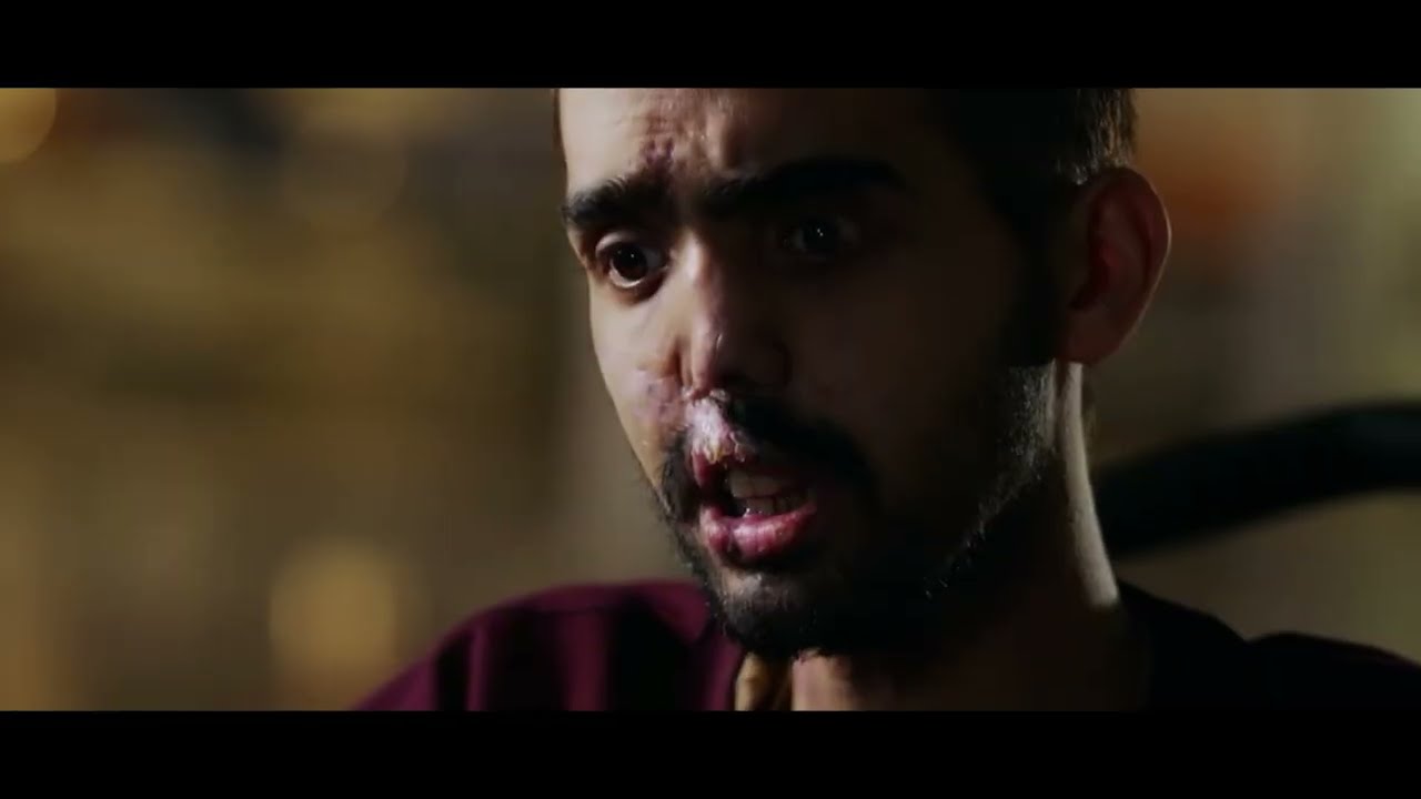 The Medical Mission: BFL Hosting World Surgeons for Amputee Veterans